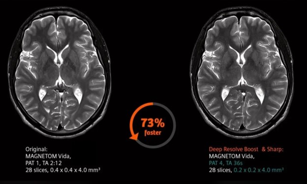 Siemens AI Software for MRI